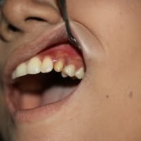 Professional Dentistry